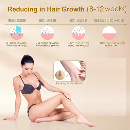 جهاز إزالة الشعر بتقنية IPL